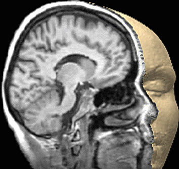 Figure 7.4